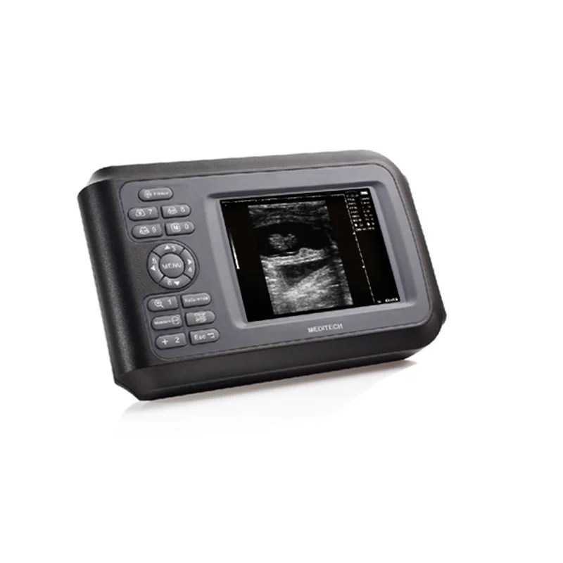 Medical Device Diagnostic Portable Digital Ultrasound Scanner SONO R