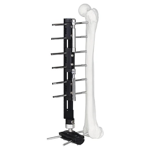 Bone Lengthening External Fixator - Type C