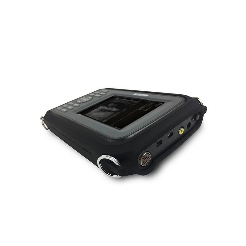 Medical Device Diagnostic Portable Digital Ultrasound Scanner SONO R